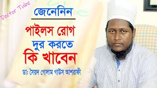 পাইলস রোগের সমস্যা সমাধান  ঘরোয়া চিকিৎসা  Piles Treatment Bangla Tips  Doctor tube [upl. by Ecraep884]