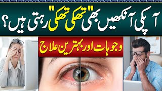 Thaki Hoi Ankhon Ka ilaj  Exercises For Tired Eyes  How To Get Rid of Eye Fatigue  Ankhon Ka Ilaj [upl. by Gastineau]