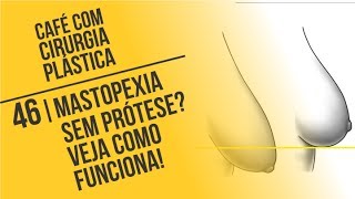 46 Mastopexia sem Prótese Veja como Funciona  Café com Cirurgia Plástica [upl. by Lareena]