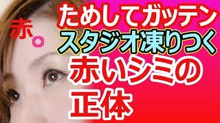 ためしてガッテン・シミ2スタジオが凍りついたquot赤いシミquotの恐怖！正体と特徴を解説 [upl. by Ahsotan110]