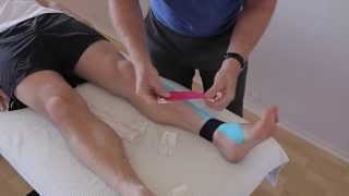 How to treat Anterior Shin Splints with Kinesiology taping [upl. by Cohette572]