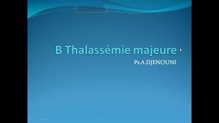 B THALASSEMIE MAJEURE [upl. by Eintroc]