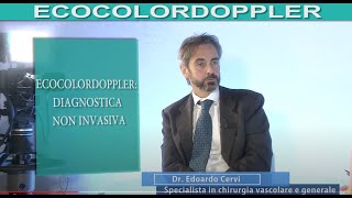 ECOCOLORDOPPLER lesame che scova linsufficienza venosa di arterie vene e capillari [upl. by Herzen]