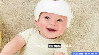 Positional Plagiocephaly Helmet Flat Head Infant Treatment [upl. by Adigun866]