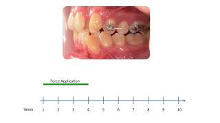 Physical properties of root cementum Part 27 Effect of lowlevel laser therapy on the repair of [upl. by Davin]