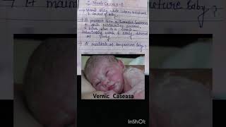 Vernix caseasa  importans in baby  gnm thirds years  nursing note nursecare [upl. by Rofotsirk105]