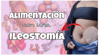 Ostomía  Ileostomía y como evacuar menos con los Alimentos  Mini video [upl. by Grannia]