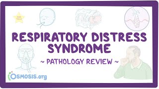 Respiratory distress syndrome Pathology Review [upl. by Glimp]