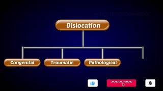 Dislocation of Joints  Types of Dislocation [upl. by Camellia]