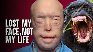 How I Survived a Chimpanzee Attack [upl. by Peppel]