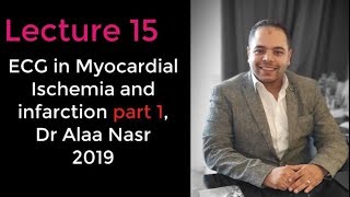 ECG from A to Z 015Alaa nasr2019myocardial ischemia and infarction part 1 [upl. by Seth]