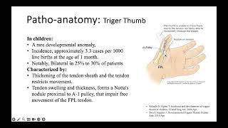 Anis Bhatti Trigger Thumb Paediatric [upl. by Sadye]