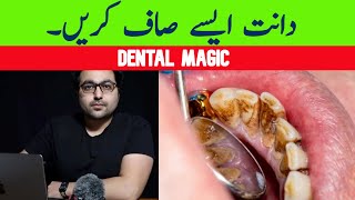 Dr ZeeThe 1 Top Remedy for Dental Plaque अस्वीकार TARTAR [upl. by Norse]