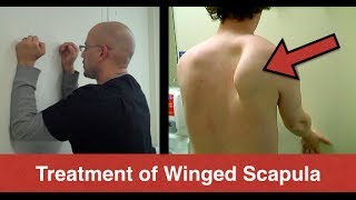 BEST Winged Scapula Exercises Fix Scapular Winging Treatment  Serratus Anterior Exercises [upl. by Kall]