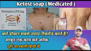 Ketost soap use benefits and Side effects full review in hindi [upl. by Irtak]