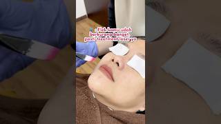 Peeling doang kok 🤭 saffaclinic klinikkecantikan melanopeel peelingwajah treatmentflek [upl. by Niveg512]