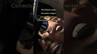 GLASS SKIN WITH THE ERBIUM LASER [upl. by Aidil]