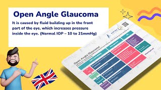 Open Angle Glaucoma  Ophthalmology [upl. by Ladnyc]