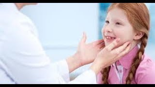 cervical lymphadenopathy in children [upl. by Ahsienal]