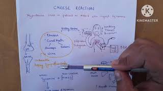 Cheese Reaction Unveiled Tyramine and MAO Inhibitors Explained [upl. by Asillem]