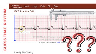 GUESS THAT RHYTHM ATRIALPACED [upl. by Naliorf]