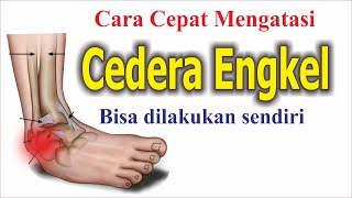 Cara Mengatasi Keseleo Engkel  Ankle Sprain  Dengan Pijat Sendiri [upl. by Krug]