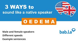 OEDEMA pronunciation  Improve your language with babla [upl. by Sualkcin]