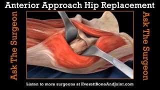 Anterior Approach for Total Hip Replacement [upl. by Philbert]