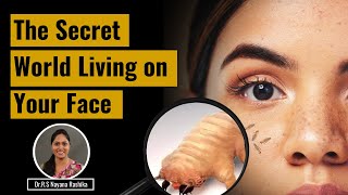 SHOCKING You Wont Believe What Lives on Your Face  Face Mites  Panchayu [upl. by Noet]