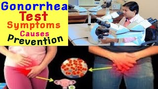 Gonorrhea गोनोरिया रोग फैलाने वाले बैक्टीरिया एवं जांच और लक्षण और बचाव ब्लॉग Bacterial Infection [upl. by Rohpotsirhc]