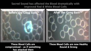 Gong Bath  Blood Testing  Before amp After Part 1 of 2 [upl. by Salli]