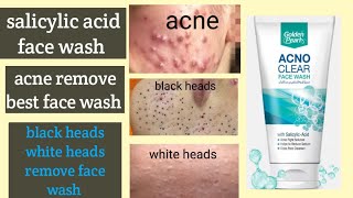 Golden pearl acno clear face wash review best salicylic acid face wash review [upl. by Rosalia711]