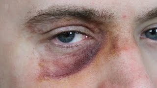 Black Eye Makeup SFX Beginners Tutorial [upl. by Boiney]