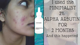 MINIMALIST ALPHA ARBUTIN 2 MONTH REVIEW [upl. by Liris817]