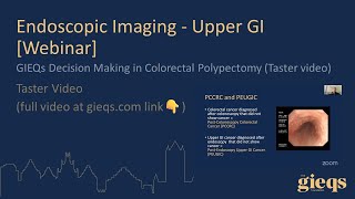 GIEQs Decision Making in Colorectal Polypectomy Taster video [upl. by Nefets663]