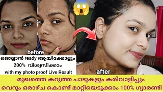 ഇതിൽ കൂടുതൽ തെളിവ് തരാൻ പറ്റില്ല 😱💯working How to remove darck spots at home MMalayalam skincare [upl. by Brout]