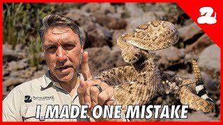 I Was Bitten by a Rattlesnake  My Story [upl. by Oira]