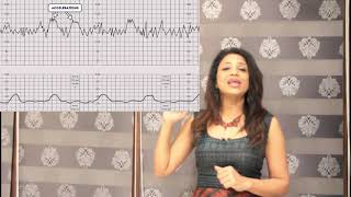 CTG cardiotocography what is CTG why is it done  how does it affect the baby [upl. by Scheer]