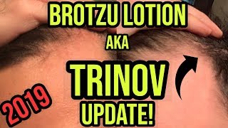 BROTZU LOTION aka TRINOV UPDATE 2019 SEE RESULTS [upl. by Lasky]