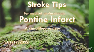 Stroke Tips Pontine infarct a simplified review [upl. by Treharne]