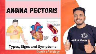 angina pectoris  angina pectoris in hindi  angina pectoris depth of biology anginapectoris [upl. by Rovaert174]