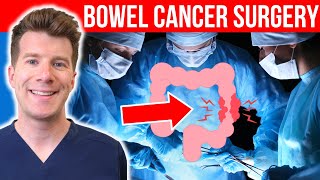 Doctor explains Bowel Cancer Surgery  Types methods stomas and more [upl. by Acirre]