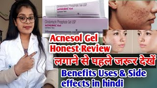 Acnesol gel  Acnesol gel honest review  Ancesol gel benefits uses amp Side effects review in hindi [upl. by Siuqaj]