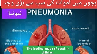 Pneumonia In Children  The Leading Cause Of Death In Babies  Prevention Of Pneumonia [upl. by Anialram594]