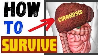 Liver Cirrhosis How To Live With Liver Cirrhosis [upl. by Krute733]