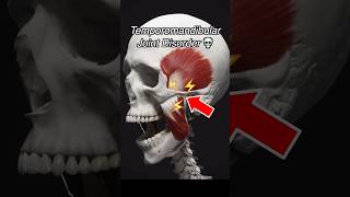 Temporomandibular Joint Dysfunction TMJ  TMD [upl. by Triley103]