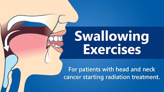 Swallowing Exercises  For Patients with Head and Neck Cancer Starting Radiation Treatment [upl. by Perrine591]