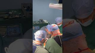 Hepatectomy I Advanced GI SURGERY I Liver Team I Surat I India [upl. by Nivlek]