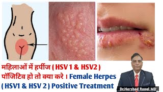 महिलाओं में हर्पीज  HSV 1 amp HSV2  पॉजिटिव हो तो क्या करे । Female Herpes Positive  HSV1 amp HSV 2 [upl. by Inva]