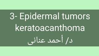 3 Epidermal tumors 👉 keratoacanthoma by Dr Ahmed Anany [upl. by Aicirtac]